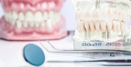 Images Studio Dentistico Associato Dr. Dalbagno e Dr. Masiello