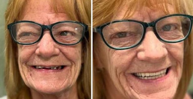 Images Redeemed Smiles - Dentures Implants & Dentistry Yukon