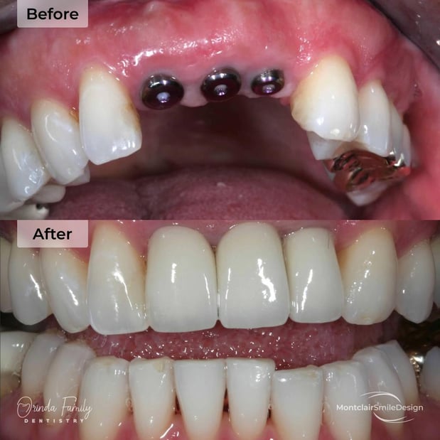 Images Orinda Family Dentistry