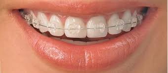 Images Clínica Dental Elisabeth Querol - Sant Mateu