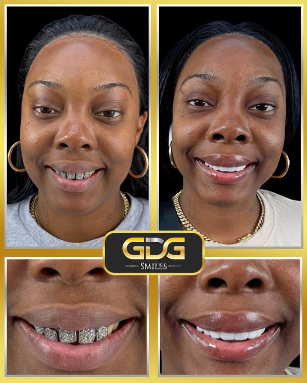 Images GDG Smiles