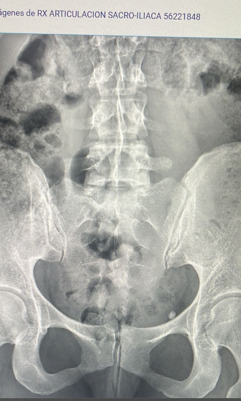 Images ARTRO-MOVIMENT FiSIOTERÀPIA