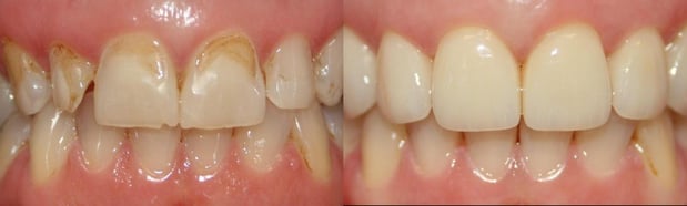 Images LaFayette Dental Associates