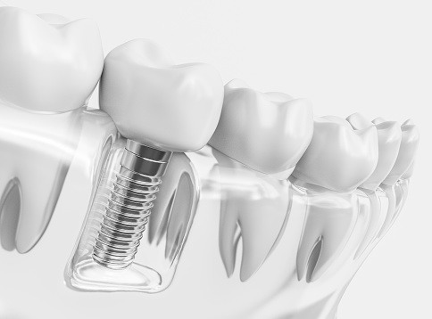 Images Les Centres Dentaires Sirois, Sabrina Sirois Denturologiste