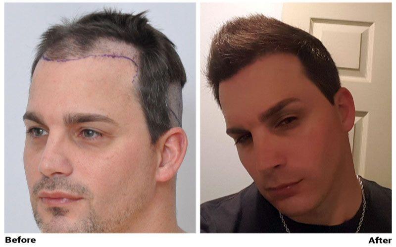 Images ForHair NYC Restoration Clinic - Dr. John Cole