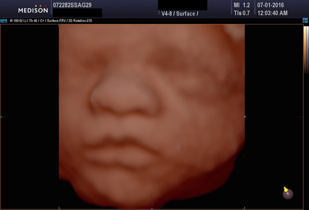 Images Heavenly 3D 4D Ultrasounds