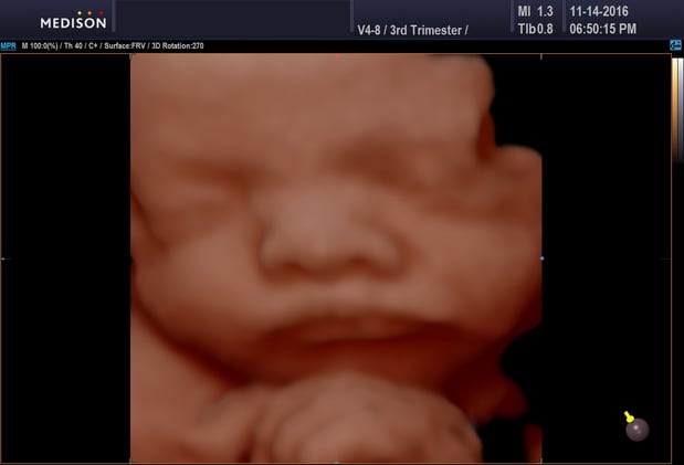 Images Heavenly 3D 4D Ultrasounds