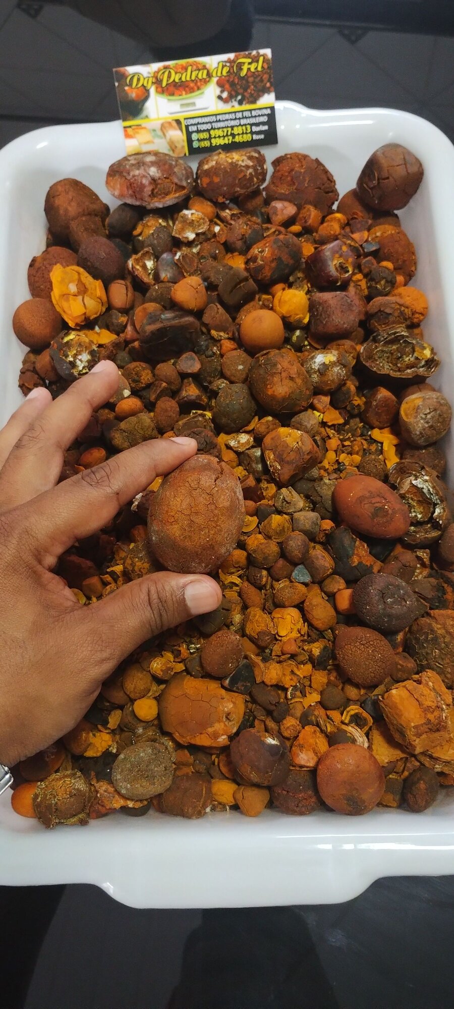 Images Dg pedras de fel bovinos