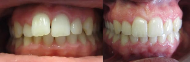 Images Premier Dental of South Orange County