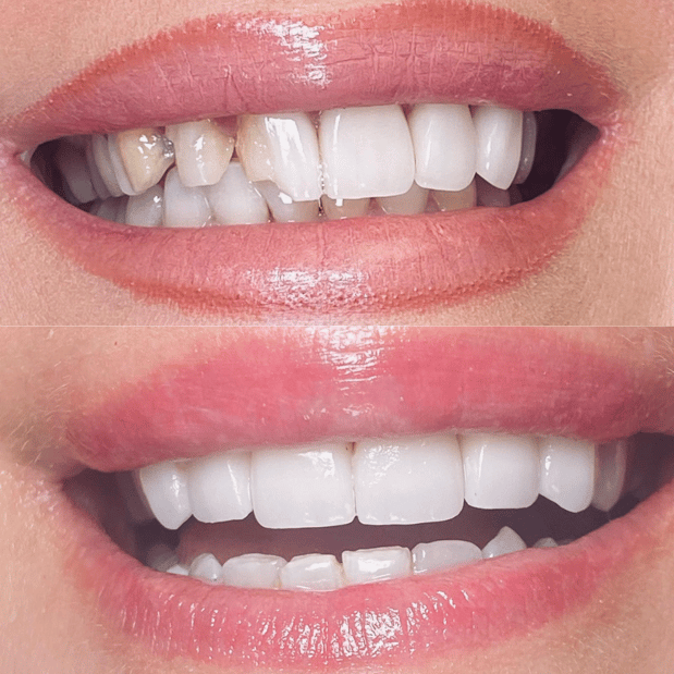 Images Selfie Smiles Dental Group