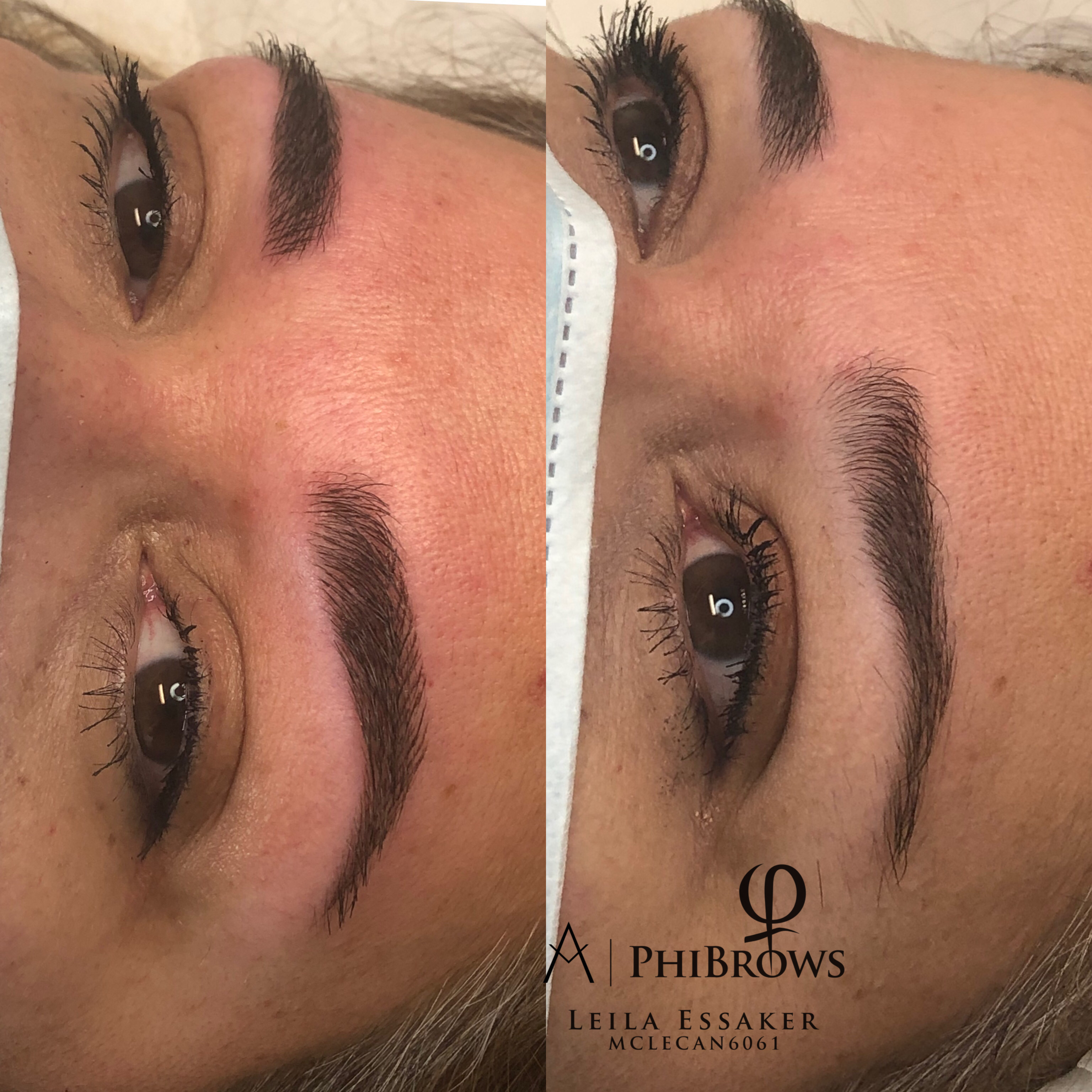 Images Clinique d'Esthétique Leila - Hydrafacial, Microblading, Épilation Laser Sainte-Foy
