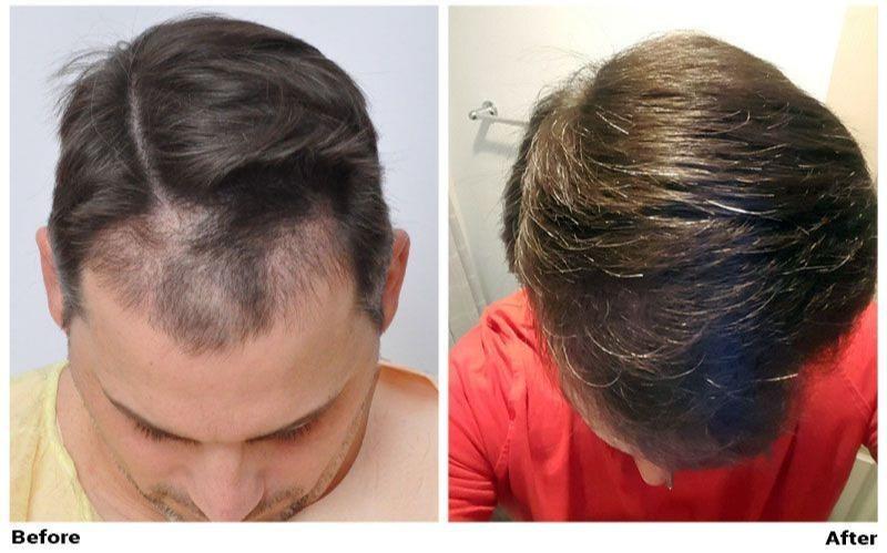 Images ForHair NYC Restoration Clinic - Dr. John Cole