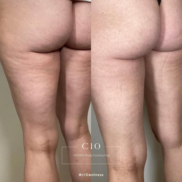 Images C10 Wellness and Rejuvenation