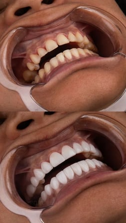 Images Gables iSmile