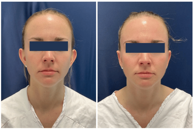 Images Columbia Aesthetic Plastic Surgery