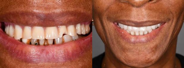 Images Staten Island Aesthetic & Implant Dentist
