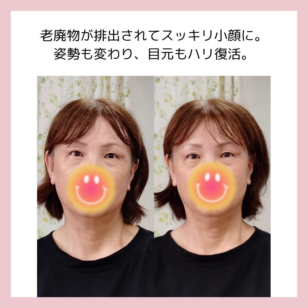 Images 目元・口元のたるみ&眉間シワ改善専門サロン