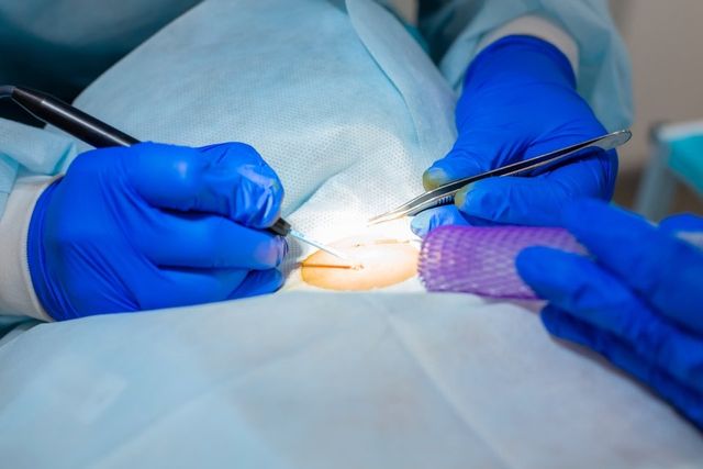 Images Marcucci Dr. Giampaolo Dermatologo