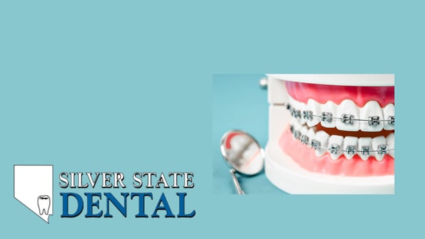 Images Silver State Dental