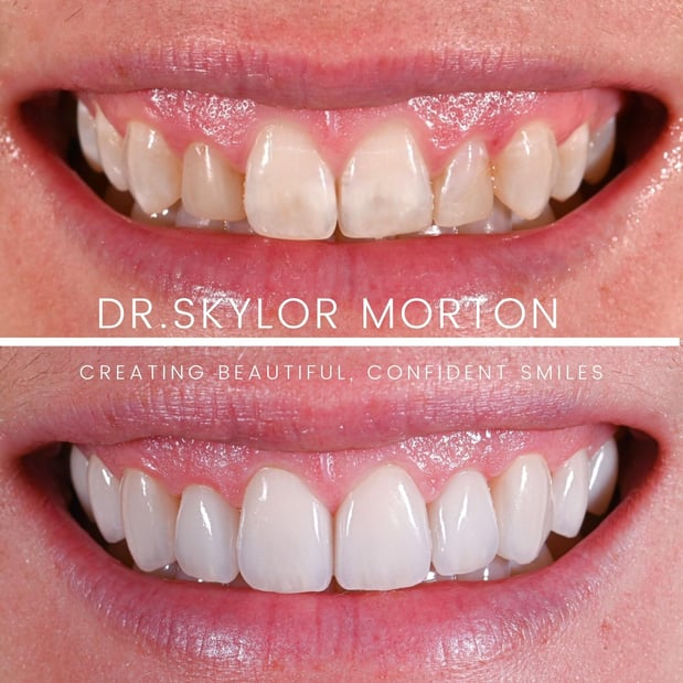 Images Nashville Wisdom Teeth and Implant Solutions