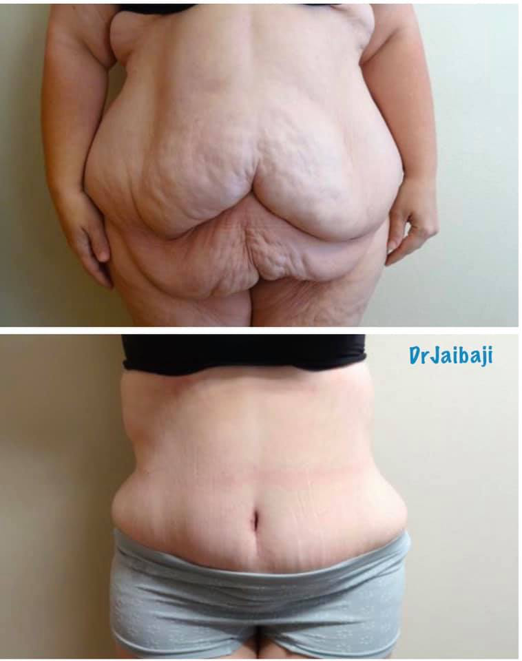 Jaibaji Plastic Surgery Photo