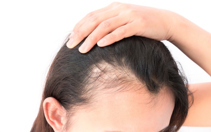 Images Follicl MD - Hair transplant - Greffe de cheveux