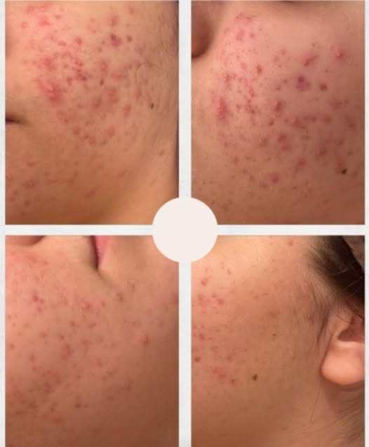 Images Estetica Raffaella