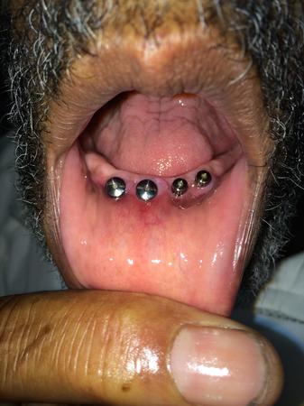 Images Oluwole Ajagbe, D.D.S., M.S