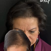 Images The Scalp Master