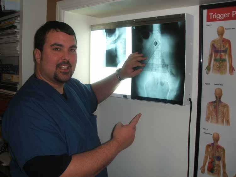 Chiropractors review X rays and MRI's to help determine which careplan is correct for your injury