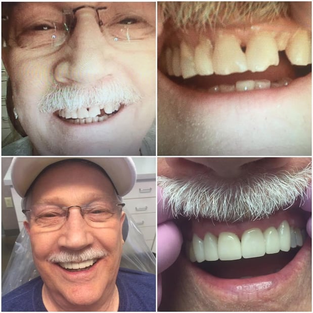 Images Jungmeyer & Suresh Dental Enterprises LLC