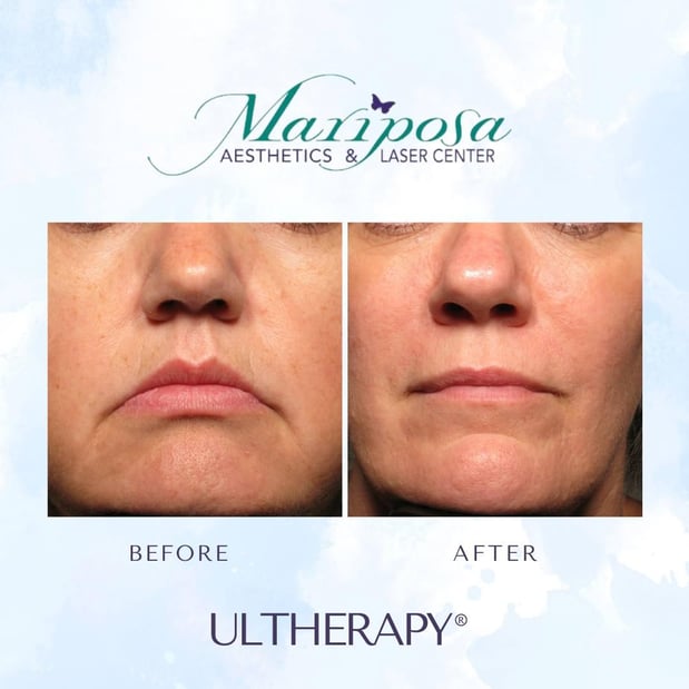 Images Mariposa Aesthetics & Laser Center