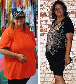 Meet Rose Panhandle Weight Loss Center Amarillo (806)677-7952