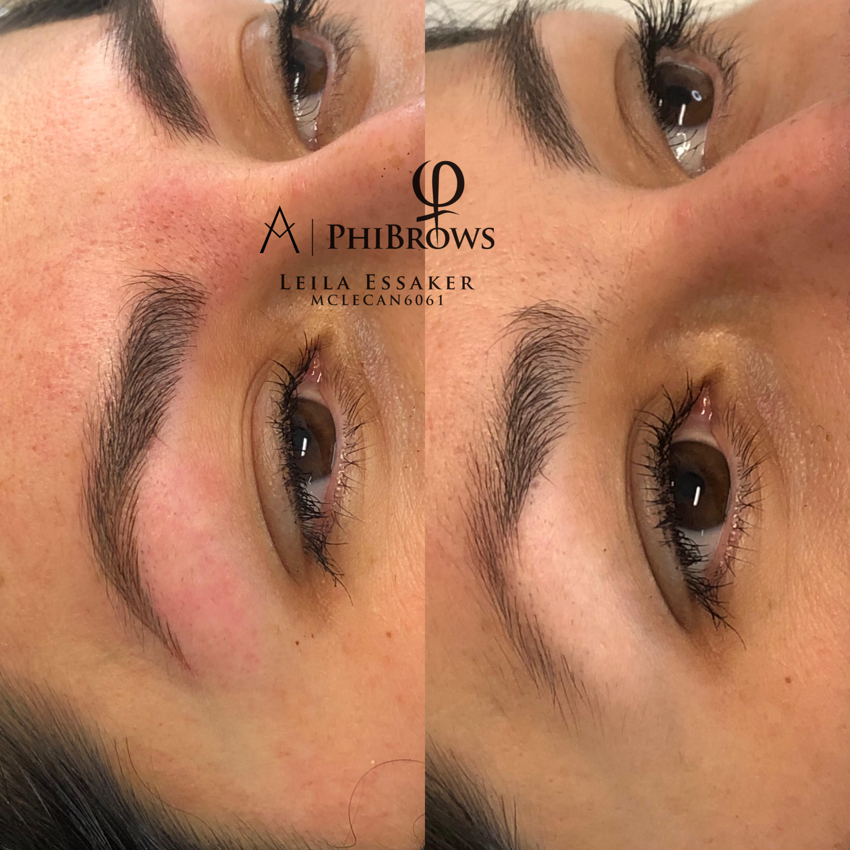Images Clinique d'Esthétique Leila - Hydrafacial, Microblading, Épilation Laser Sainte-Foy