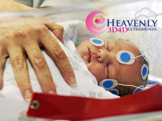 Images Heavenly 3D 4D Ultrasounds