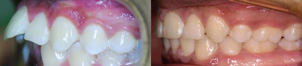 Images TLC Pediatric Dentistry and Orthodontics