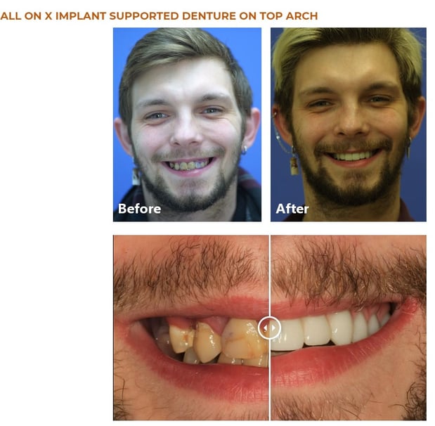 Images David A. Rice, DDS