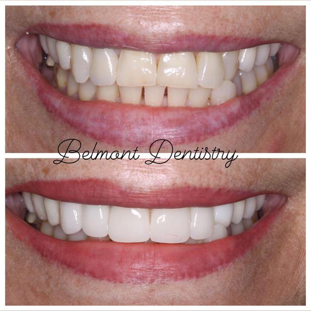 Images Belmont Dentistry Scottsdale