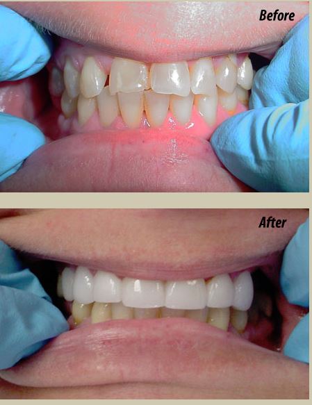 Images Neal Martin Dentistry