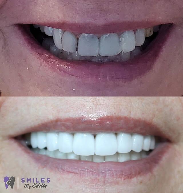 Images Smiles By Eddie: Dr. Edmond Ahdoot DDS