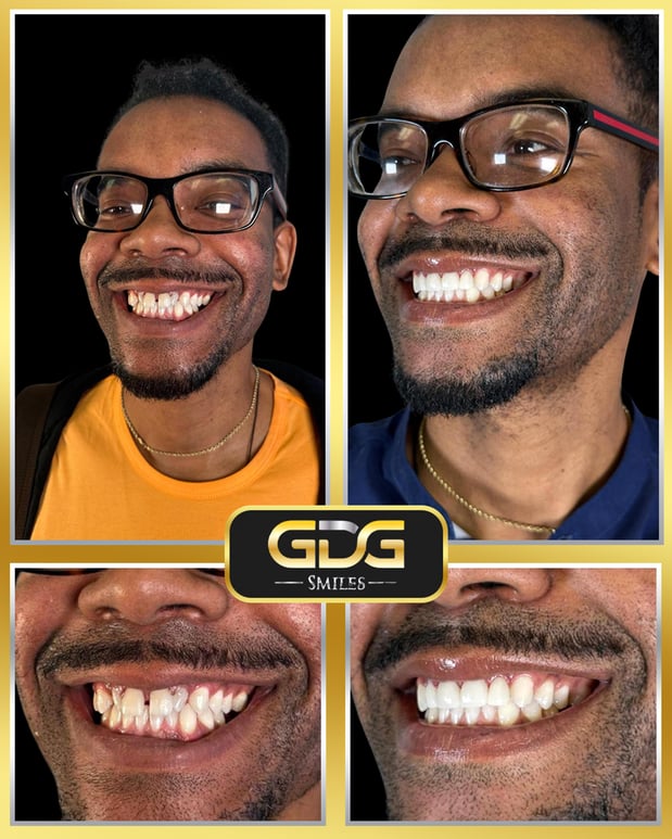 Images GDG Smiles