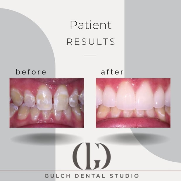 Images Gulch Dental Studio