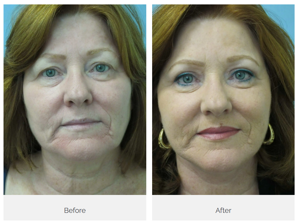 Castellano Cosmetic Surgery Center Image