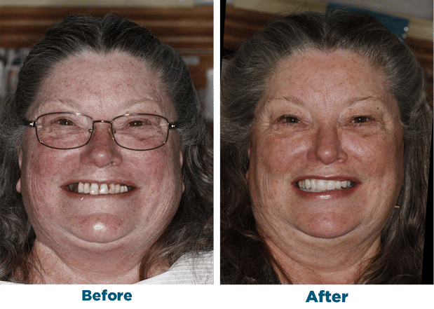 Images Smiles for Life Dental Care - Bridgewater