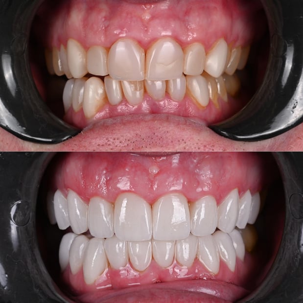 Images Nashville Wisdom Teeth and Implant Solutions