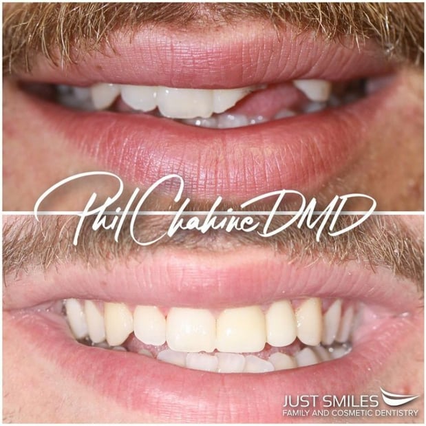 Images Just Smiles - General, Cosmetic & Implant Dentistry