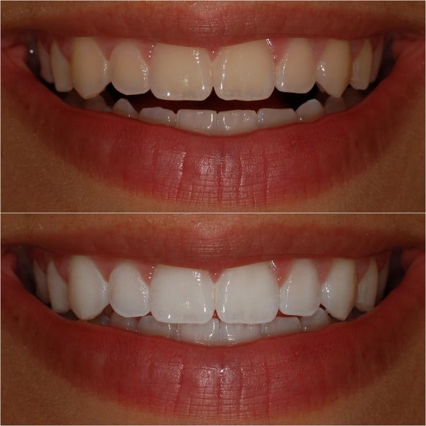 Images Pacific Dental Care