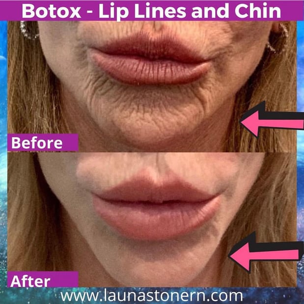 Images Launa Stone, R.N.