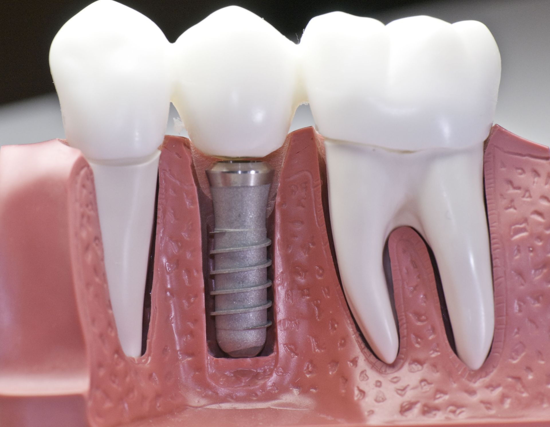 Eagle River Smiles Aaron B Baird DDS Image