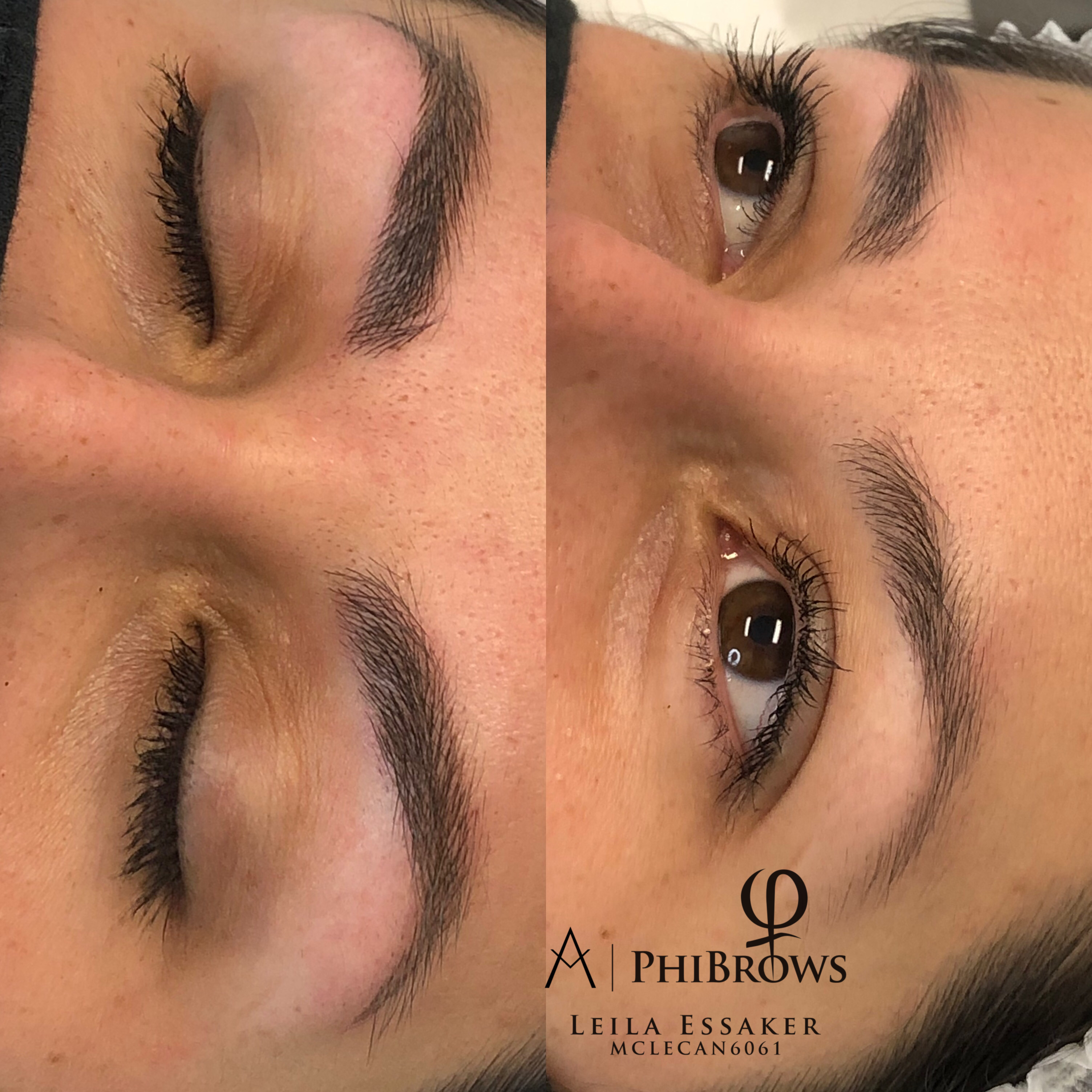 Images Clinique d'Esthétique Leila - Hydrafacial, Microblading, Épilation Laser Sainte-Foy